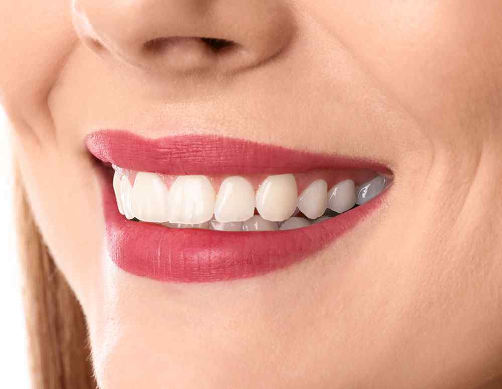 https://dental-vita.it/wp-content/uploads/2020/02/teeth-after.jpg